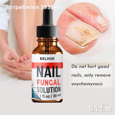 Продукт за лечение на гъбички по ноктите Eelhoe , снимка 6 - Други - 43765392