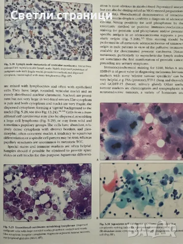 Fine Needle Aspiration Cytology - Orell, Sterrett, Whitaker, снимка 4 - Специализирана литература - 49459237