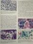 Fine Needle Aspiration Cytology - Orell, Sterrett, Whitaker, снимка 4