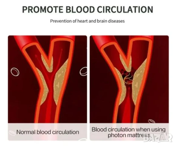 Неволно Изпускане на Урина Инконтиненция Укрепване на Тазовите Мускули Стягане на Тазовото Дъно Жени, снимка 14 - Масажори - 50727798