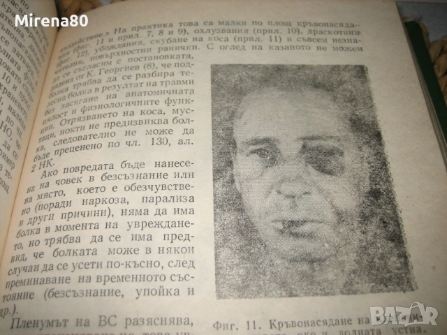 Съдебномедицинска експертиза на живи лица - 1986 г., снимка 9 - Специализирана литература - 52094107