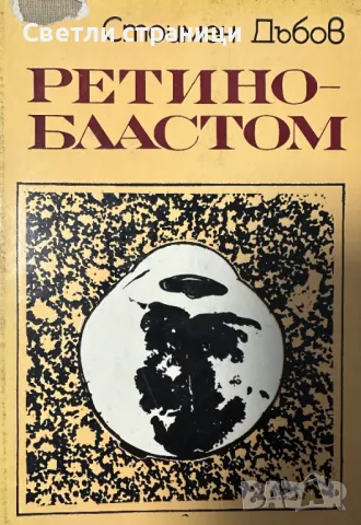 Ретинобластом - Стоимен Дъбов