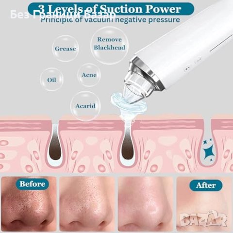 Нова 1080p Камера за черни точки Професионална Грижа за Кожата, снимка 4 - Други - 43132012