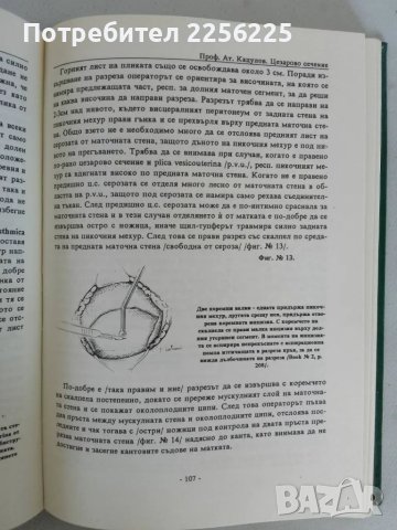 Цезарово сечение , снимка 3 - Специализирана литература - 47534272