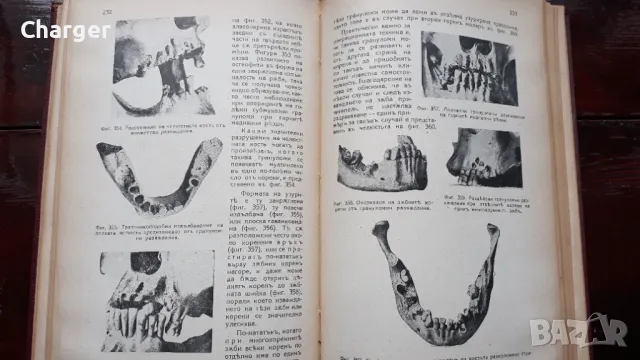 Ръководство по зъбни болести - 1938 год., снимка 9 - Антикварни и старинни предмети - 48920826
