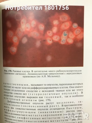 Патологическая анатомия. Атлас - В. В. Серов, Н. Е. Ярыгин, В. С. Пауков, снимка 6 - Специализирана литература - 28598429
