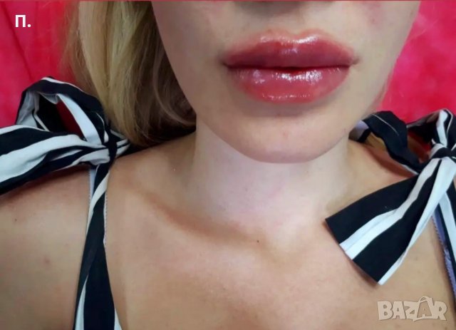 5мл. Филър за инжектор ПЕН, снимка 6 - Козметика за лице - 34778990