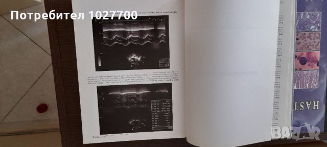 Лекарска книга на турски език за професионалисти, снимка 9 - Специализирана литература - 33068143