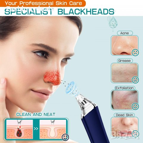 Вакуум за премахване на черни точки Инструмент за почистване на порите, снимка 5 - Други - 33620505