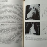 Болести на сърдечно-съдовата система  1968 г., снимка 5 - Специализирана литература - 27569788