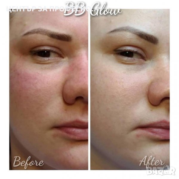 Курс BB Glow - Процедура от ново поколение, снимка 1
