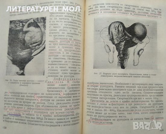 Кардинални въпроси в акушерството Л. Ламбрев 1961 г., снимка 3 - Специализирана литература - 27592727