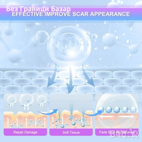 Нов Интензивен крем за белези и стрии – изглаждане и възстановяване на кожата, снимка 3 - Други - 51905727