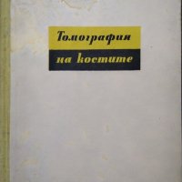 Томография на костите. Г. Хаджидеков, Б. Ботев 1957 г., снимка 4 - Специализирана литература - 27589751