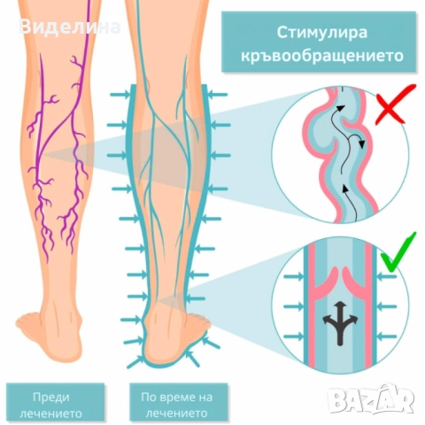 Апарат за венозна тренировка и облекчение на тежестта в краката Venen Walker Basic, снимка 5 - Масажори - 51854730