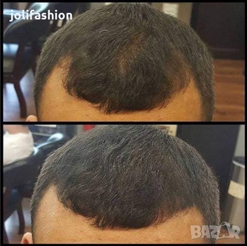 Toppis - фибри за коса | Най-добра Цена в България!