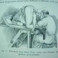 Медицинска книга Изследване на уринарната система, 1909 , френска, снимка 18 - Специализирана литература - 33406019