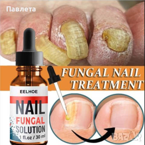 Продукт за лечение на гъбички по ноктите Eelhoe , снимка 5 - Други - 43765392