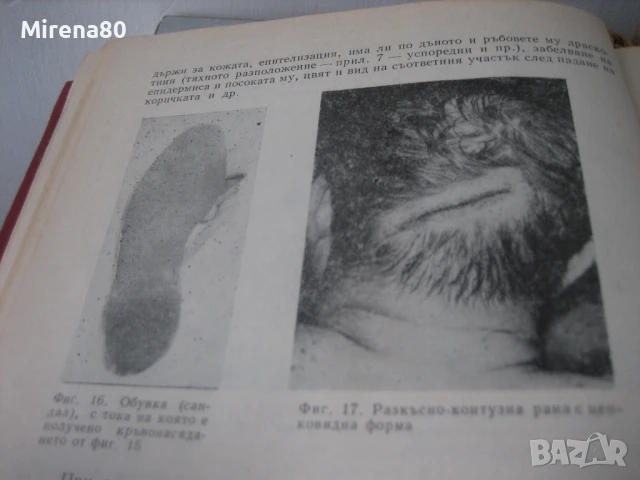 Ръководство за практически упражнения по съдебна медицина - 1981 г., снимка 5 - Специализирана литература - 50677776