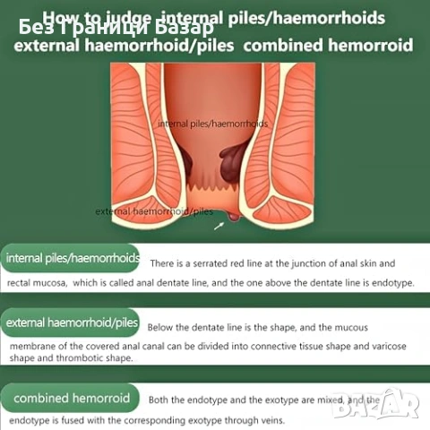 Нов Успокояващ крем за хемороиди 20г с растителни екстракти Здраве тяло, снимка 4 - Други - 53155840