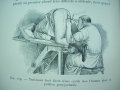 Медицинска книга Изследване на уринарната система, 1909 , френска, снимка 18