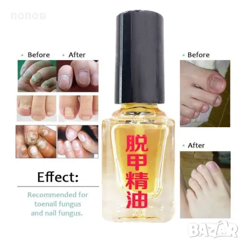 лак против гъбички на ноктите - 100% ефективно 