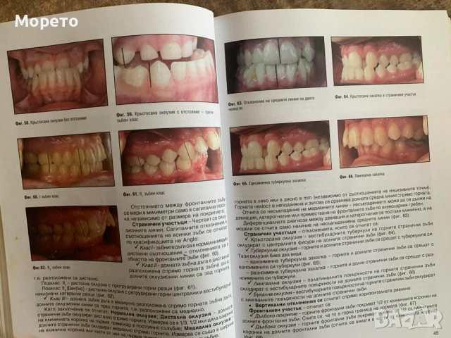 Ръководство по ортодонтия за студенти-проф.Вера Крумова, снимка 8 - Специализирана литература - 52864027