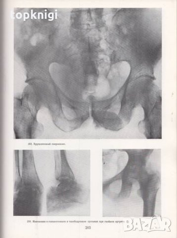 Рентгенодиагностический атлас. Том 1: Болезни опорни-двигательного аппарата, снимка 2 - Специализирана литература - 26772749