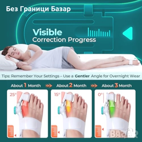 Нов Ортопедичен изправител за палеца – облекчение при болка и деформация, снимка 3 - Други - 51772903