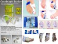 Goodnight bunion протектор ортеза за палеца на крака, снимка 5
