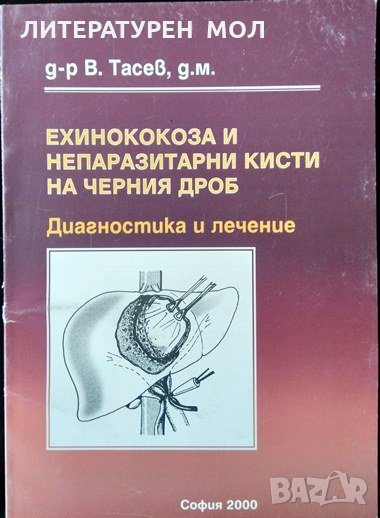 Ехинококоза и непаразитни кисти на черния дроб. В. Тасев 2000 г., снимка 1
