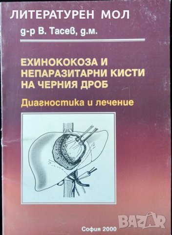 Ехинококоза и непаразитни кисти на черния дроб. В. Тасев 2000 г.