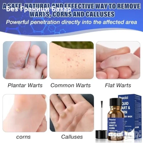 Нов Бърз лек за брадавици и мазоли течен препарат 15ml без болка, снимка 4 - Други - 51108424