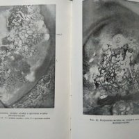 Ранна диагностика и профилактика на рака на женските полови органи. 1955 г., снимка 5 - Специализирана литература - 27589697