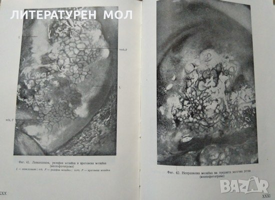 Ранна диагностика и профилактика на рака на женските полови органи. 1955 г., снимка 5 - Специализирана литература - 27589697