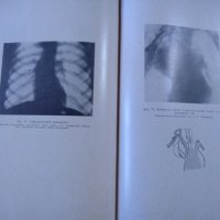 Болезни сердечно-сосудистой системы. Владимир Ф. Зеленин 1956 г., снимка 4 - Специализирана литература - 26269636