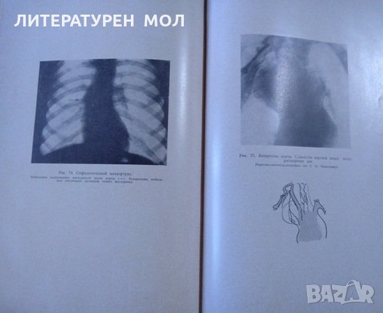 Болезни сердечно-сосудистой системы. Владимир Ф. Зеленин 1956 г., снимка 4 - Специализирана литература - 26269636