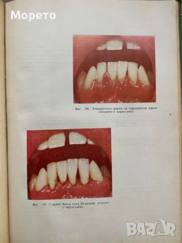 Терапевтична стоматология-Димитър Свраков, снимка 6 - Специализирана литература - 52863831