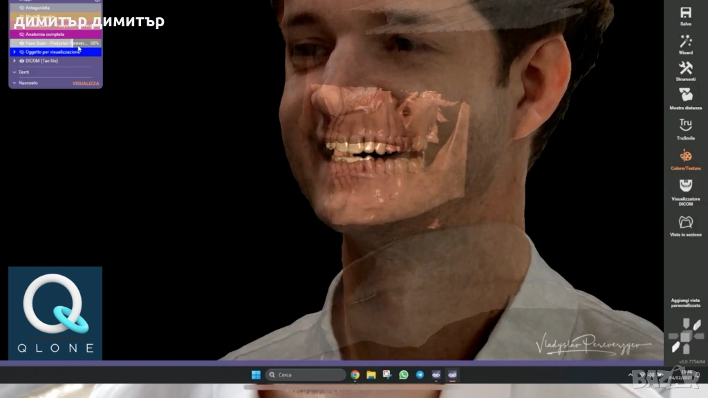 инсталация на дентални софтуери , снимка 1