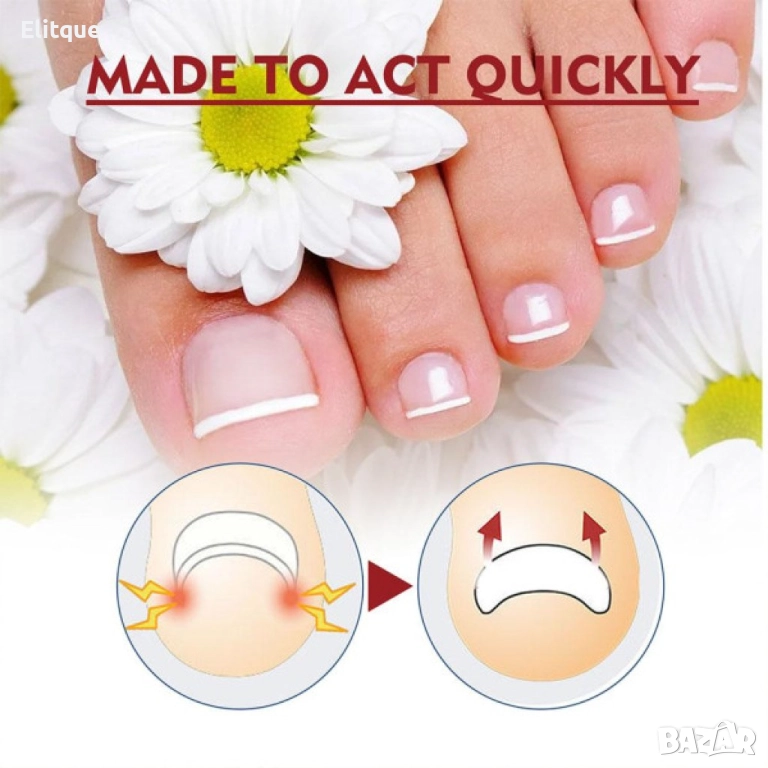 Капки за врастнали нокти с противогъбично и дезинфекциозно действие 10ml, снимка 1