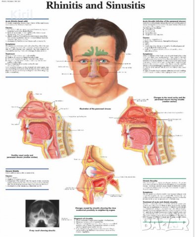 BioNase БиоНасе уникален уред за лазерна терапия и лечение на хрема, алергичен ренинт и синузит, снимка 13 - Други - 39778075