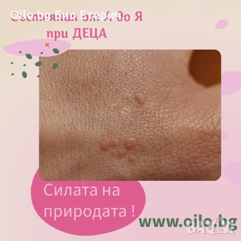 Брадавици при деца? Решението е в природата!