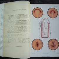 Медицинска книга Изследване на уринарната система, 1909 , френска, снимка 11 - Специализирана литература - 33406019