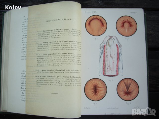 Медицинска книга Изследване на уринарната система, 1909 , френска, снимка 11 - Специализирана литература - 33406019