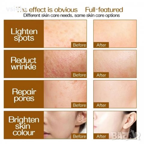 Дерма ролер ZGTS с 192 титаниеви игли, снимка 3 - Други - 38355598