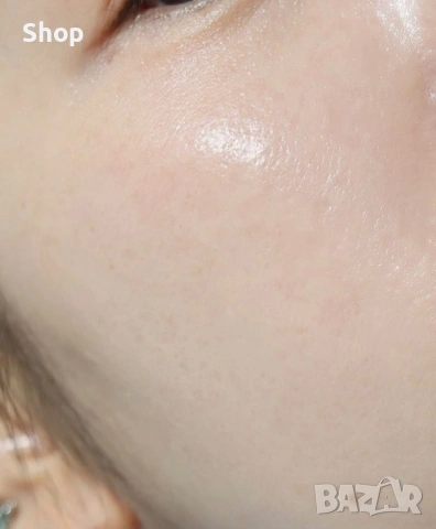 -50% Tretinoin cream 