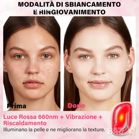 Електрически радиочестотен лифтинг масаж за лице , снимка 2 - Друга електроника - 50277898