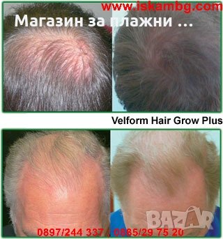 GROW COMB Лазерна четка - Пеборете оплешивяването, снимка 6 - Други стоки за дома - 28345142