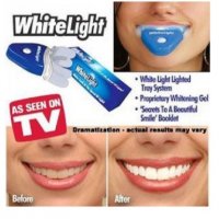 Ултравиолетова система за избелване на зъби White Light 10 , снимка 2 - Други - 32958368