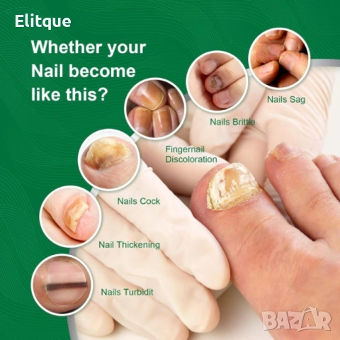 Спрей за възстановяване на увредени нокти 10ml, снимка 13 - Други - 52901546